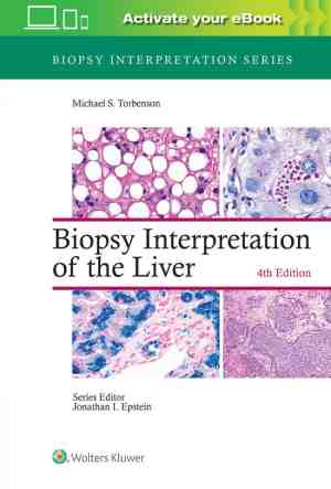 Foto: Biopsy interpretation series  biopsy interpretation of the liver