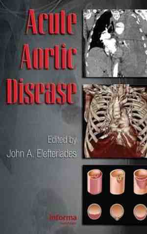 Foto: Acute aortic disease