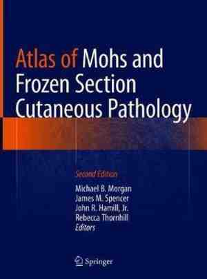 Foto: Atlas of mohs and frozen section cutaneous pathology