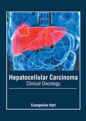 Foto: Hepatocellular carcinoma clinical oncology