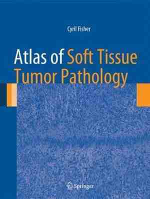 Foto: Atlas of soft tissue tumor pathology