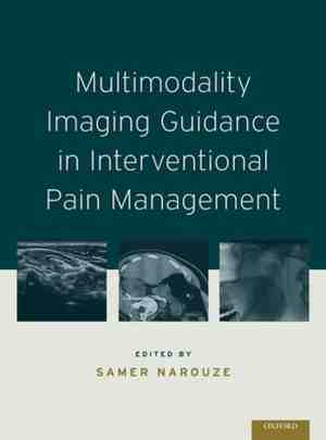 Foto: Multimodality imaging guidance in interventional pain management