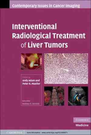 Foto: Contemporary issues in cancer imaging   interventional radiological treatment of liver tumors