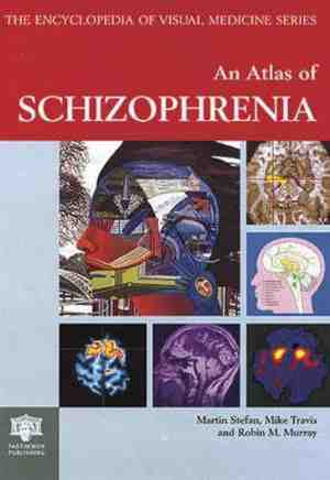 Foto: Atlas of schizophrenia