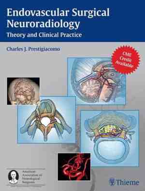 Foto: Endovascular surgical neuroradiology