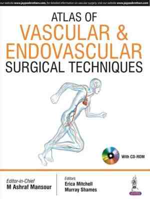 Foto: Atlas of vascular endovascular surgical techniques
