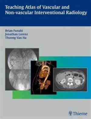 Foto: Teaching atlas of vascular and non vascular interventional radiology
