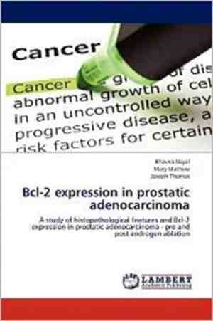 Foto: Bcl 2 expression in prostatic adenocarcinoma