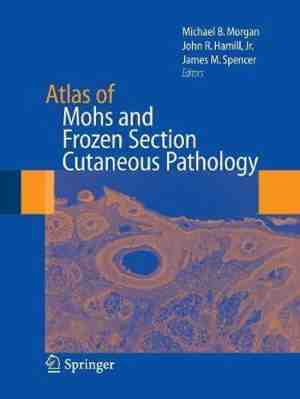 Foto: Atlas of mohs and frozen section cutaneous pathology