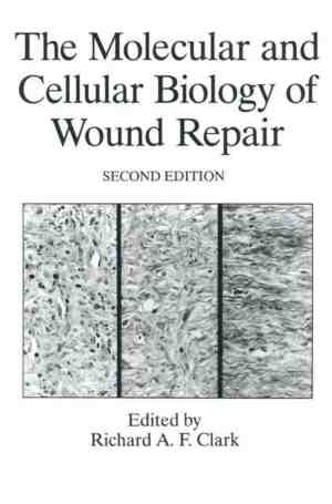 Foto: The molecular and cellular biology of wound repair