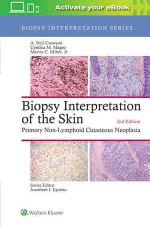 Foto: Biopsy interpretation of the skin primary nonlymphoid cutaneous neoplasia biopsy interpretation series