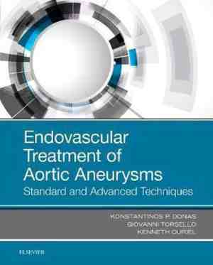 Foto: Endovascular treatment of aortic aneurysms