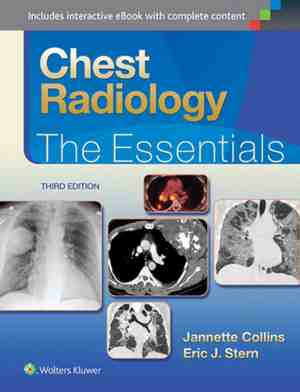 Foto: Chest radiology 3e