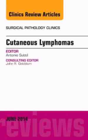 Foto: Cutaneous lymphomas an issue of surgical pathology clinics