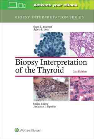 Foto: Biopsy interpretation of the thyroid biopsy interpretation series