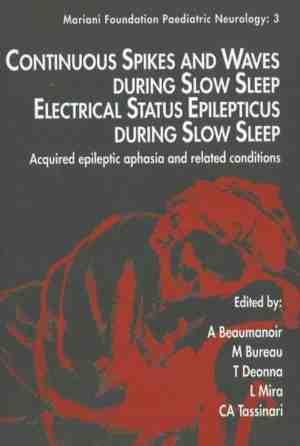 Foto: Continuous spikes waves during slow sleep electrical status epilepticus during slow sleep